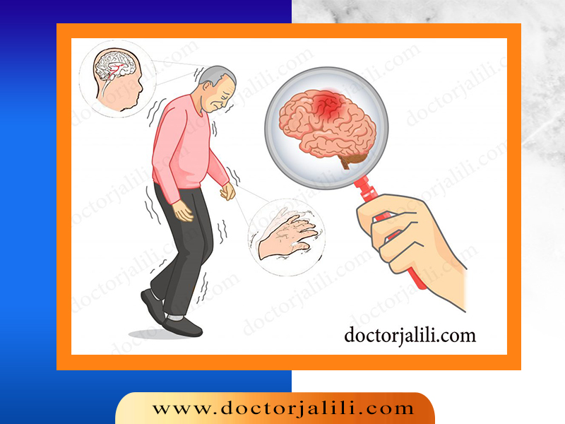 پارکینسون ؛ نام یک بیماری خطرناک